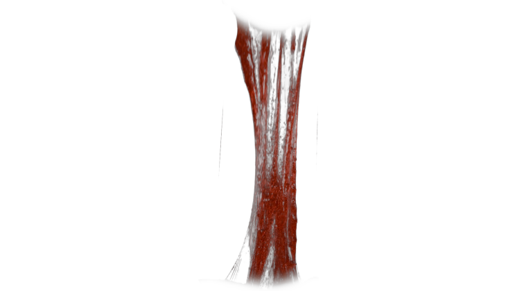 HD VFX of  Bloody Vertical Slime Pull 