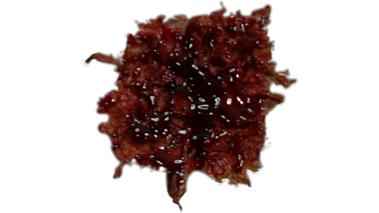 Free Video Effect of Bleeding Wound   Blunt Force