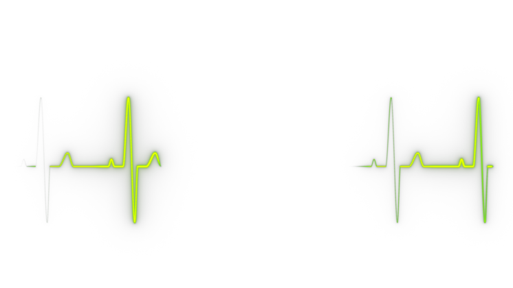 HD VFX of Heart Monitor Line 