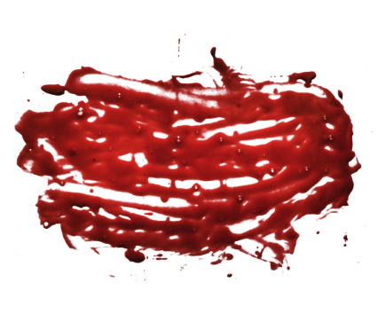 Blood Smear 11