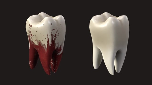 3D Model: Tooth