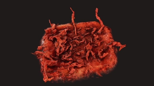3D Model: Blood Wound 1